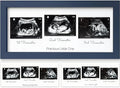 Trio Baby Sonogram Frame (Midnight Blue)
